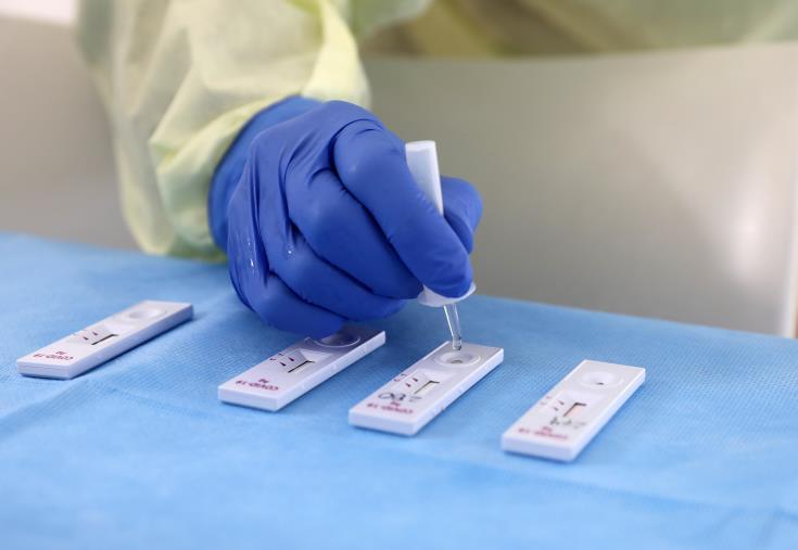 Παγώνη: Είμαστε γεμάτοι ιούς – Κάθε οικογένεια έχει γρίπη ή covid