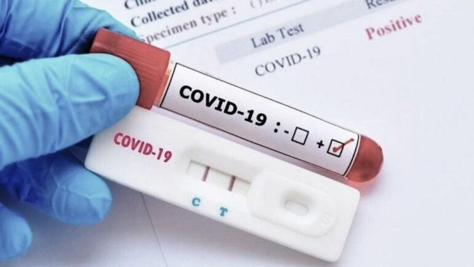 Πραγματοποίηση τεστ ταχείας διάγνωσης Covid- 19 στη Σύρο