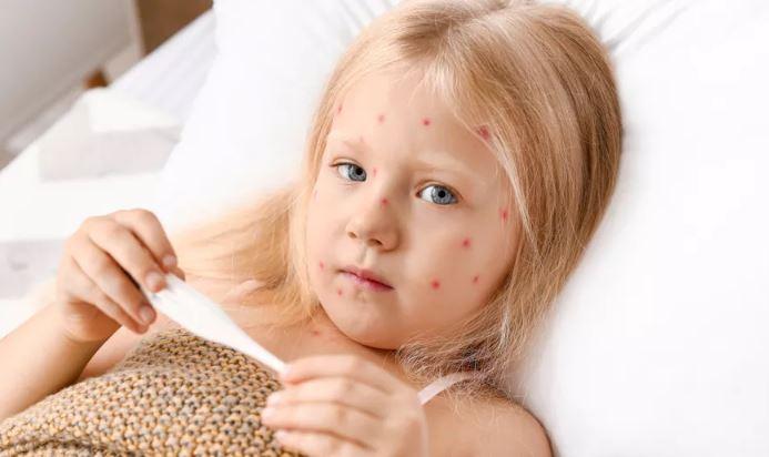 Ιλαρά και ερυθρά «επιστρέφουν» στην Ευρώπη – Η κατάσταση στην Ελλάδα