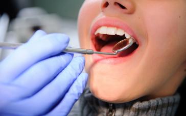 Dentist Pass: Παράταση προθεσμίας υποβολής αιτήσεων μέχρι 22 Δεκεμβρίου