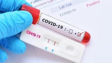 Πραγματοποίηση τεστ ταχείας διάγνωσης Covid- 19 στη Σύρο