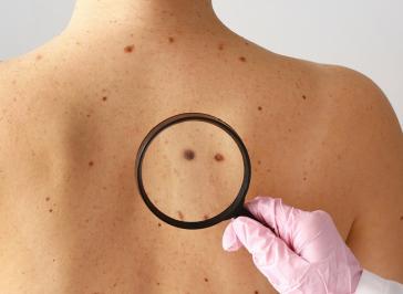 "Η πρόληψη σώζει ζωές"