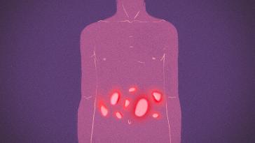 Στρες, άγχος, απομόνωση – Η ζωή με τη νόσο του Crohn