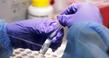 Ο ΠΟΥ εγκρίνει το πρώτο rapid test για την ευλογιά των πιθήκων